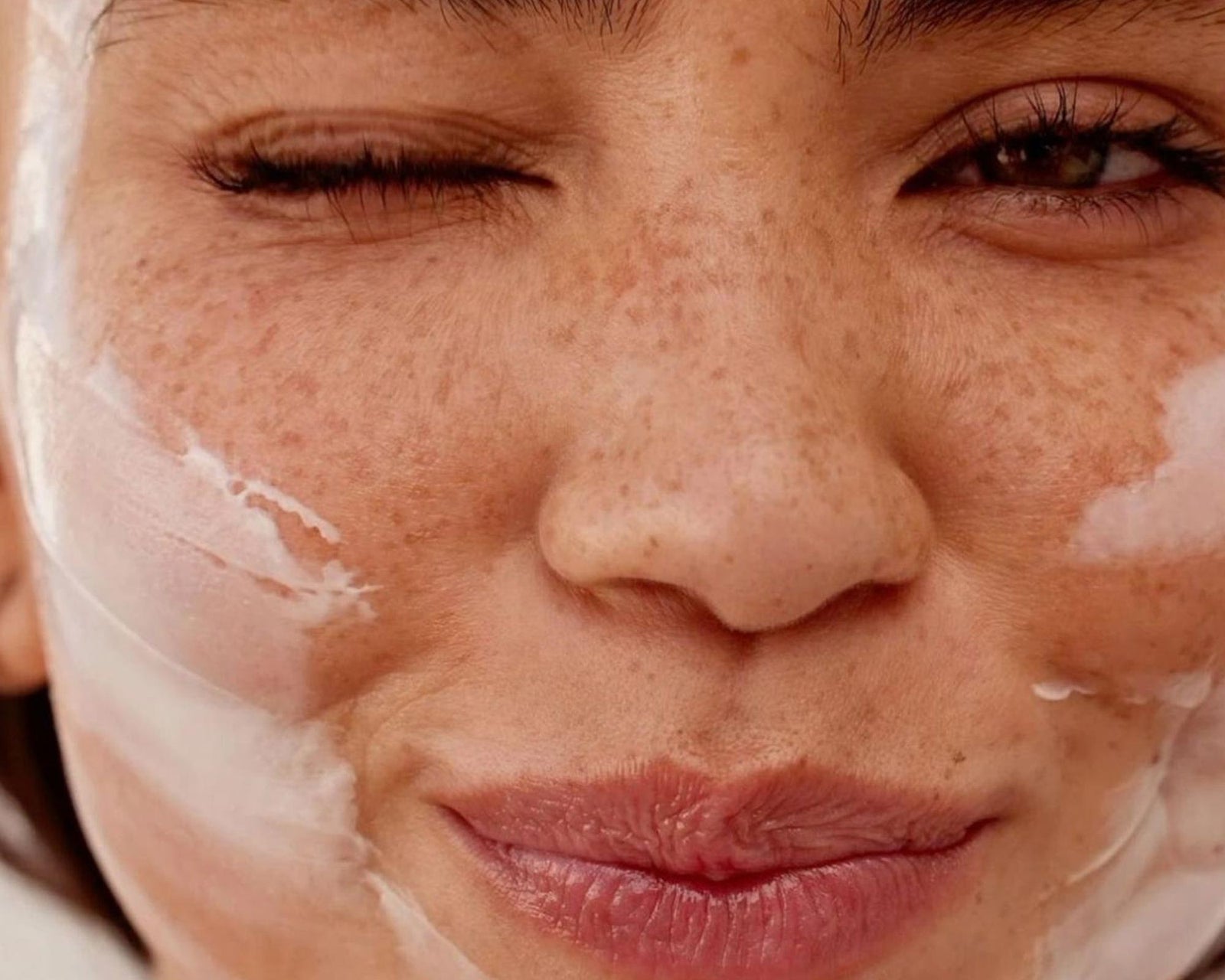 UREA: YOUR SKIN HERO FOR ALL SKIN CONDITIONS